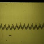 registro-de-presion-intracraneal-150x150