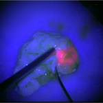 cirugia-epilepsia-microscopio-fluorescente-m