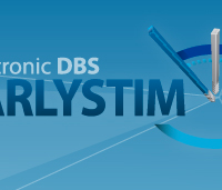 Neurostimulation for Parkinson disease with early motor complications. Earlystim Study