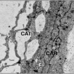 Células aracnoideas de la capa barrera (CAB), en la porción inter- na de la lámina aracnoidea (tercera porción). Células aracnoideas de la capa de aracnoides reticular (cuarta porción), origen del trabeculado arac- noideo (CAT) en contacto con el líquido cefalorraquídeo. Microscopía elec- trónica de transmisión