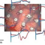 potenciales evocados somatosensoriales (PESS)