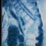 docencia-pregraduados-facultad de medicina uam- rm-dorsal-paciente-tuberculosis