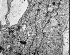 Detalle de las células aracnoideas de capa barrera. Se observan uniones especializadas de membrana entre las membranas plasmáticas. Microscopía electrónica de transmisión.