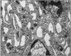 Porción de la aracnoides reticular que se inicia por dentro de la capa barrera de la aracnoides. Entre las células aracnoideas reticulares se delimitan amplios espacios con líquido cefalorraquídeo