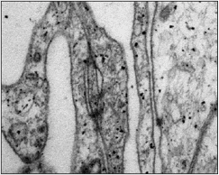 Detalle de las células aracnoideas en la zona de transición entre las capa barrera y reticular de la aracnoides. Microscopía electrónica de transmisión.