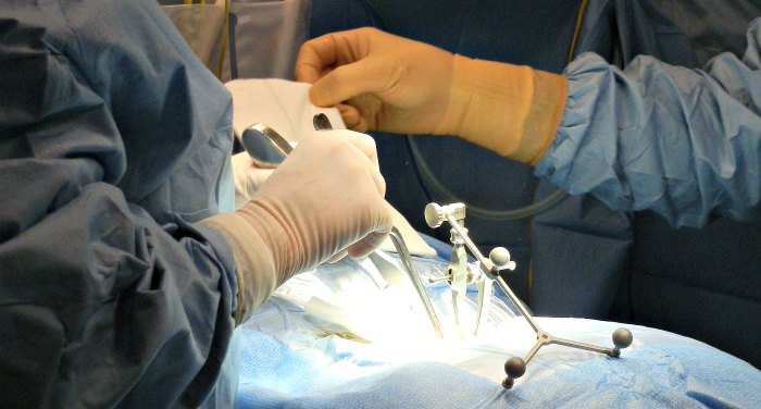 Operando en la Unidad de Neurocirugía