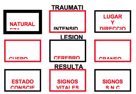 Traumatismo caraneoencefálico -Esquema de Hooper