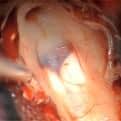 9th Hands-On Course on Neurosurgical Approaches