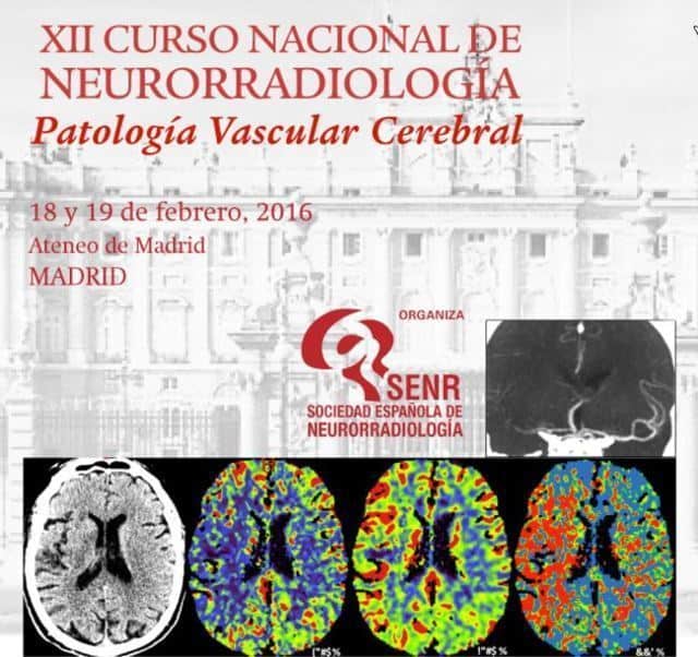 xii-curos-neurorradiologia-2016-3