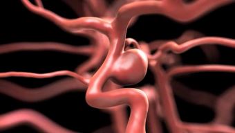 senec-cursos de neurocirugia-3