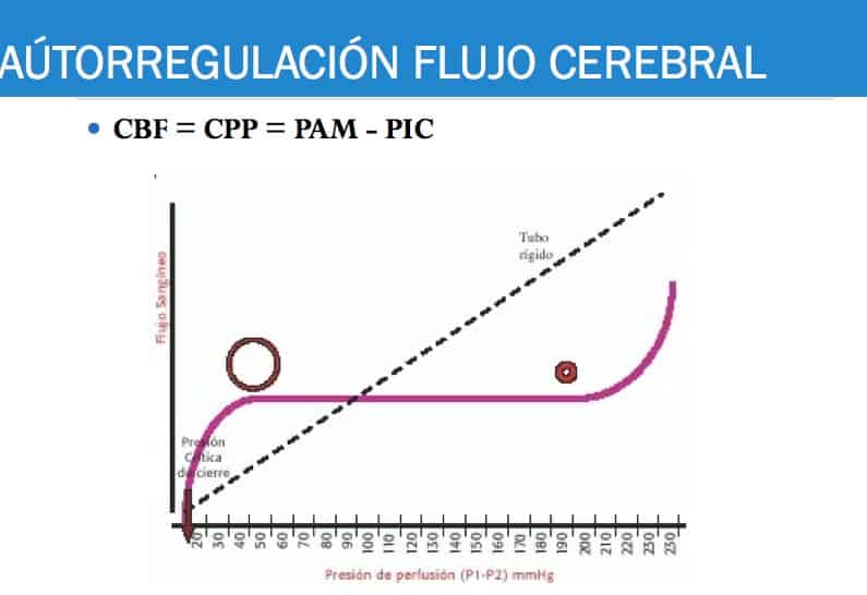 Presión de perfusión cerebral