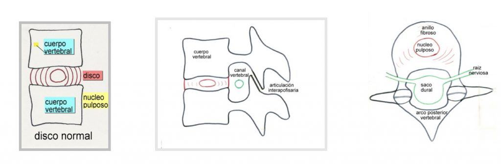 Figura 1.- Esquemas en proyección sagital y axial de vértebras y disco intervertebral