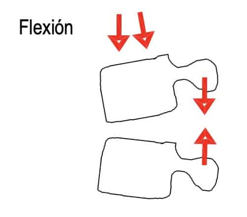 Figura 2.- Esquema de lesión de ligamentos posteriores por flexión