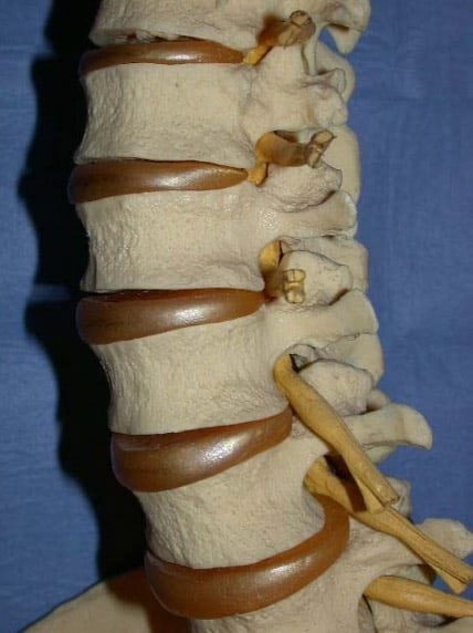 Figura 2.- Modelo de columna vertebral. Se visualiza las vértebras, discos y raíces