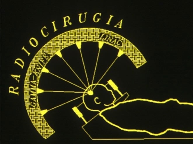 Figura 5.- Concepto de Radiocirugía