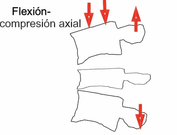 Figura 5.- Esquema fractura por Flexión-Compresión axial