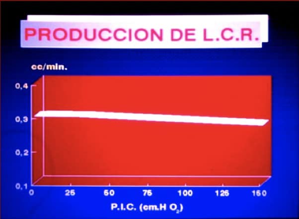 Figura 6.- RM sagital donde se observa tumor en la fosa posterior, que desplaza las amígdalas cerebelosas hacia el agujero magno.