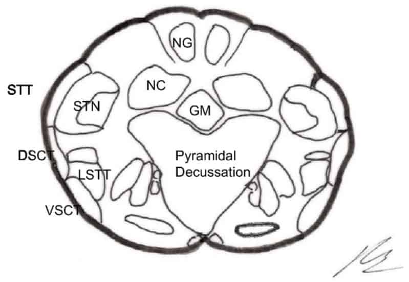 Section of the trigeminal spinal tract (TST)