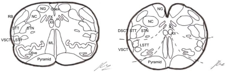 Sections at the level of the obex and 2–3 mm below