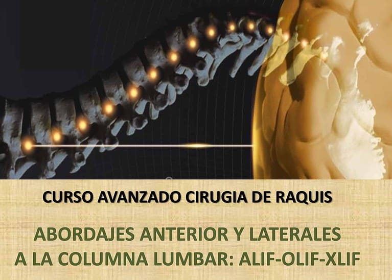 CURSO AVANZADO CIRUGIA RAQUIS ABORDAJE POSTERIOR CERVICAL ABORDAJE POSTERIOR LUMBAR. En Laboratorio de Anatomía Quirúrgica. 12 de Abril de 2024.