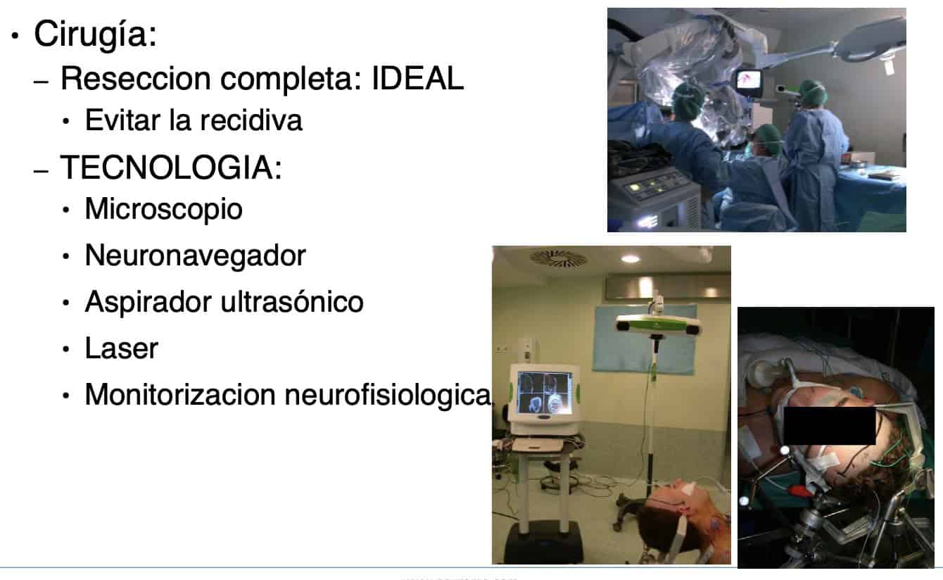 Figura 12.- tumores cerebrales tratamiento