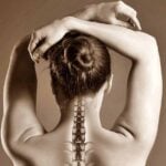 hernia de disco cervical