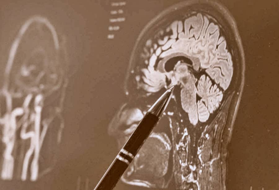 accede al temario para alumnos de medicina en la especialidad de neurocirugía