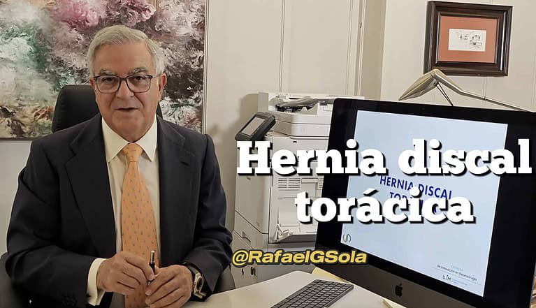 Charla video de rafael garcia de sola Hernia discal torácica