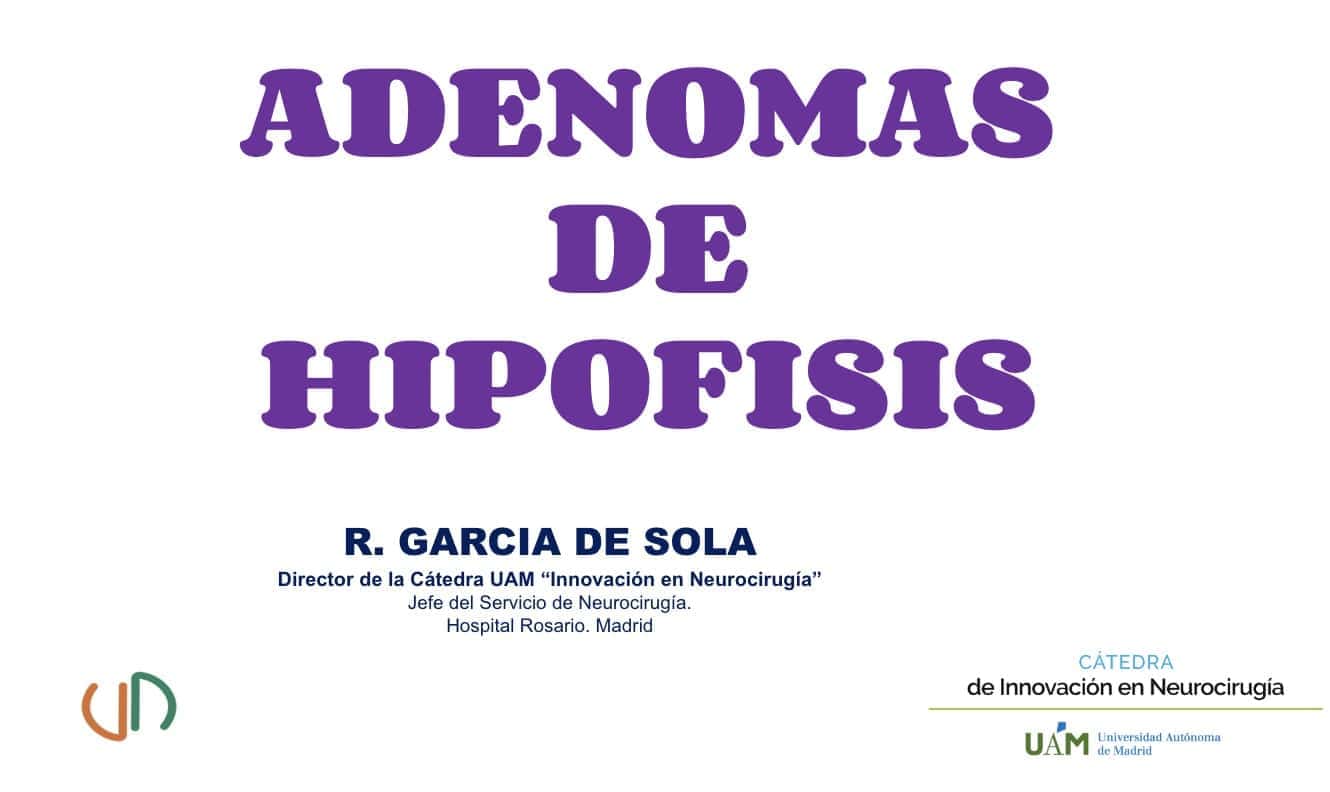 adenoma de hipofisis-rafael garcia de sola