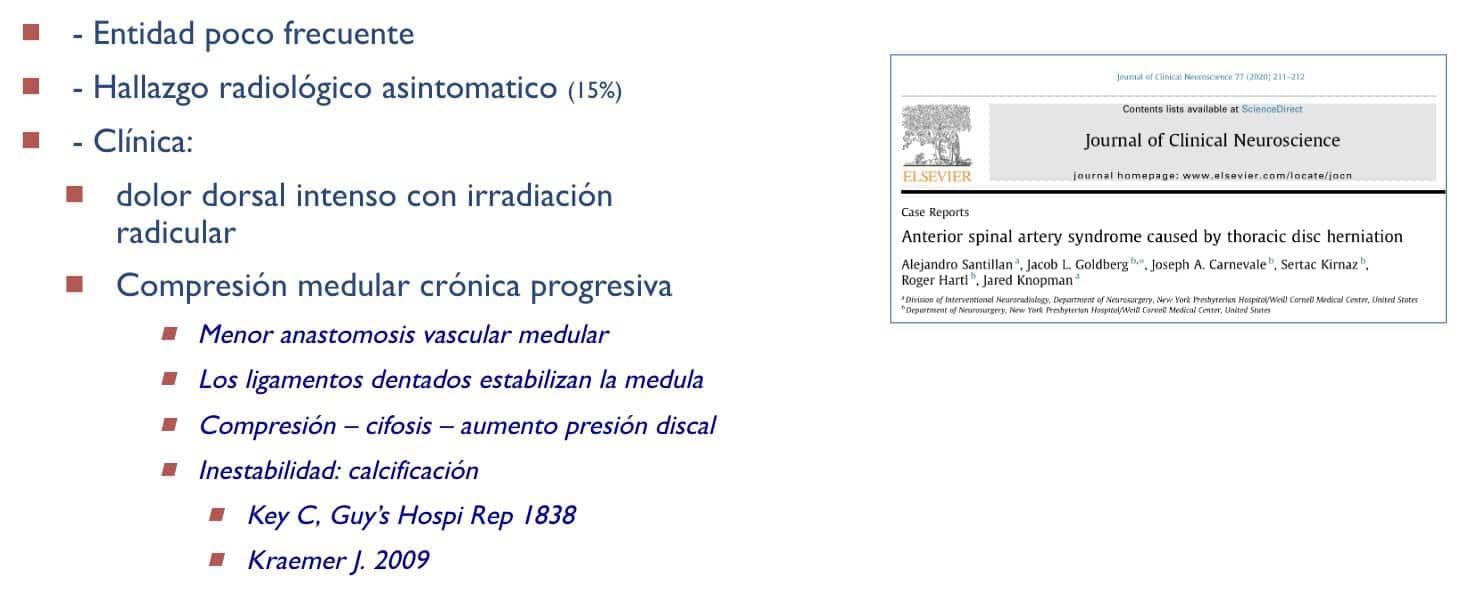 02 Abordaje transfacetario a la hernia discal torácica-introduccion