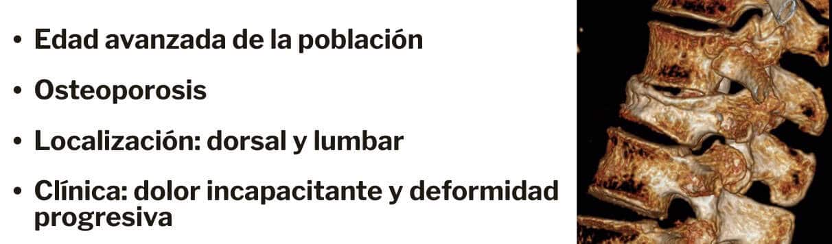 incidencia de fracturas vertebrales en personas de edad avanzada