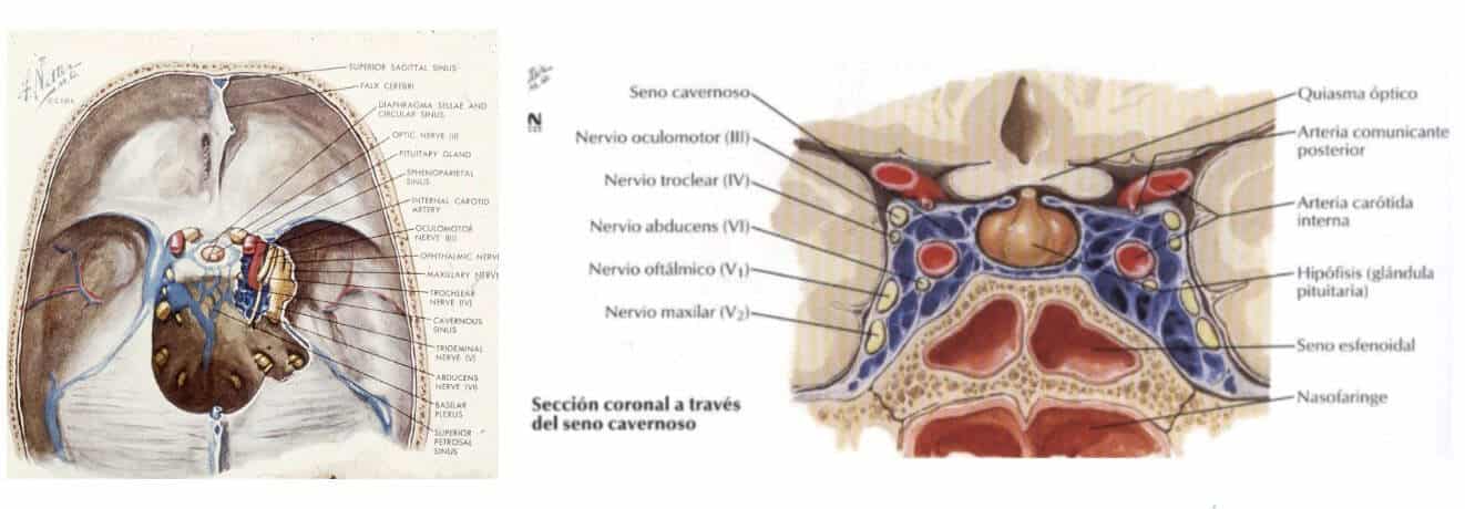 Figura 03-adenoma de hipofisis-anatomia.