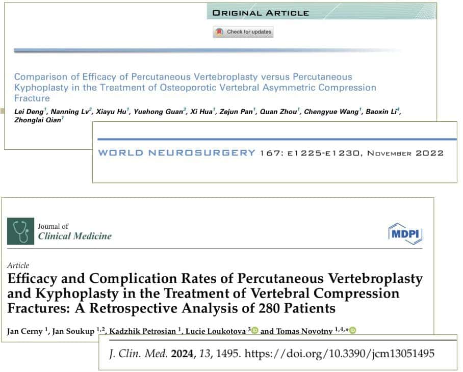 ventajas de los tratamientos de vertebroplastia