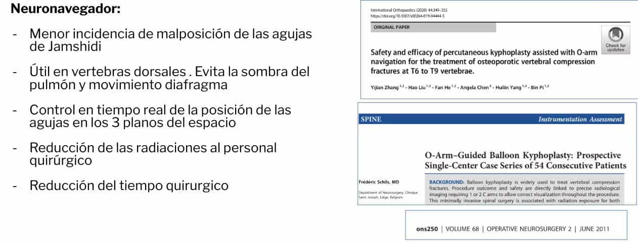 utilización del neuronavegador