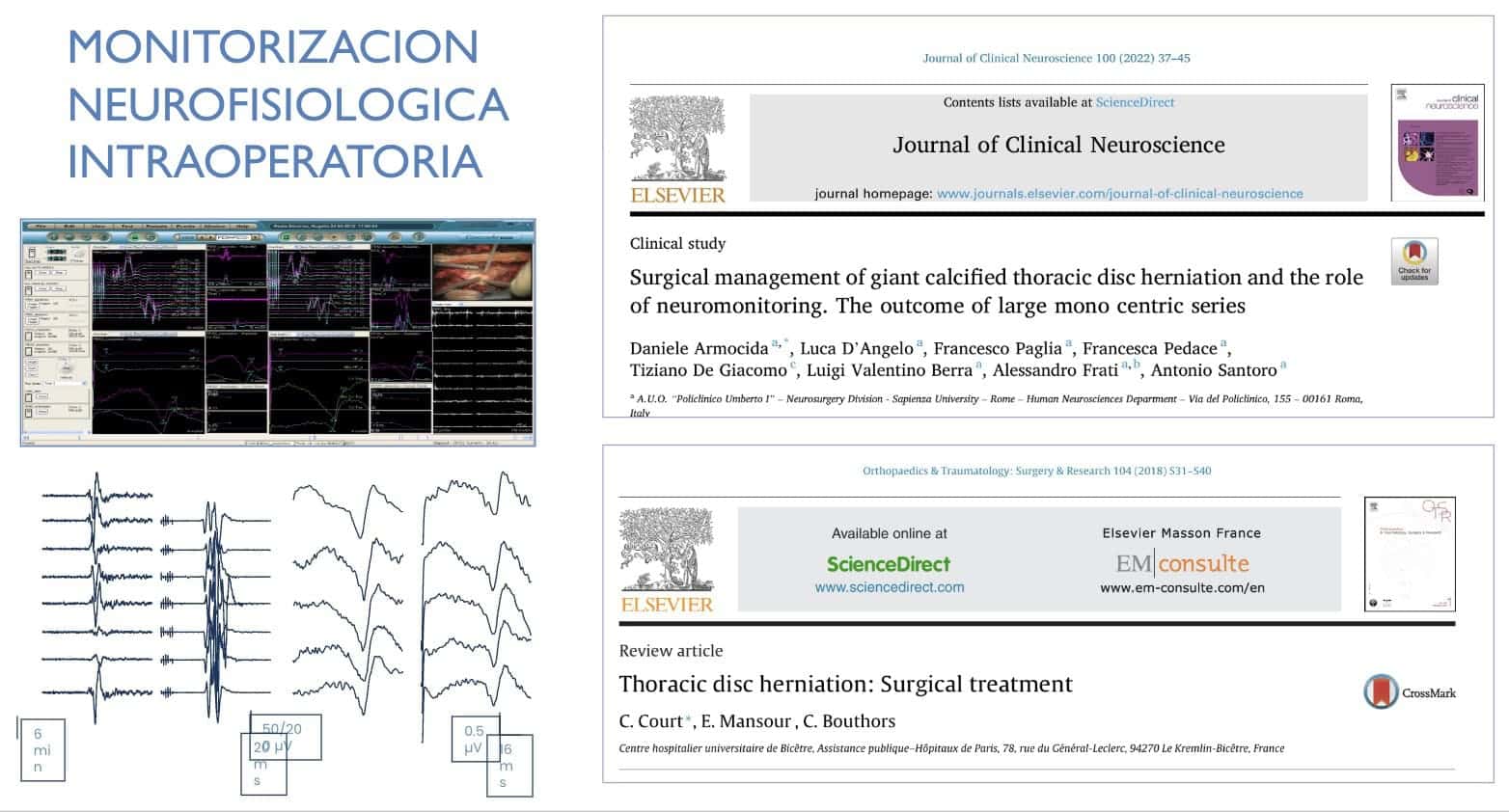 MONITORIZACION NEUROFISIOLOGICA INTRAOPERATORIA