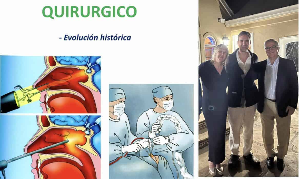 Figura 19-adenoma de hipofisis-tratamiento