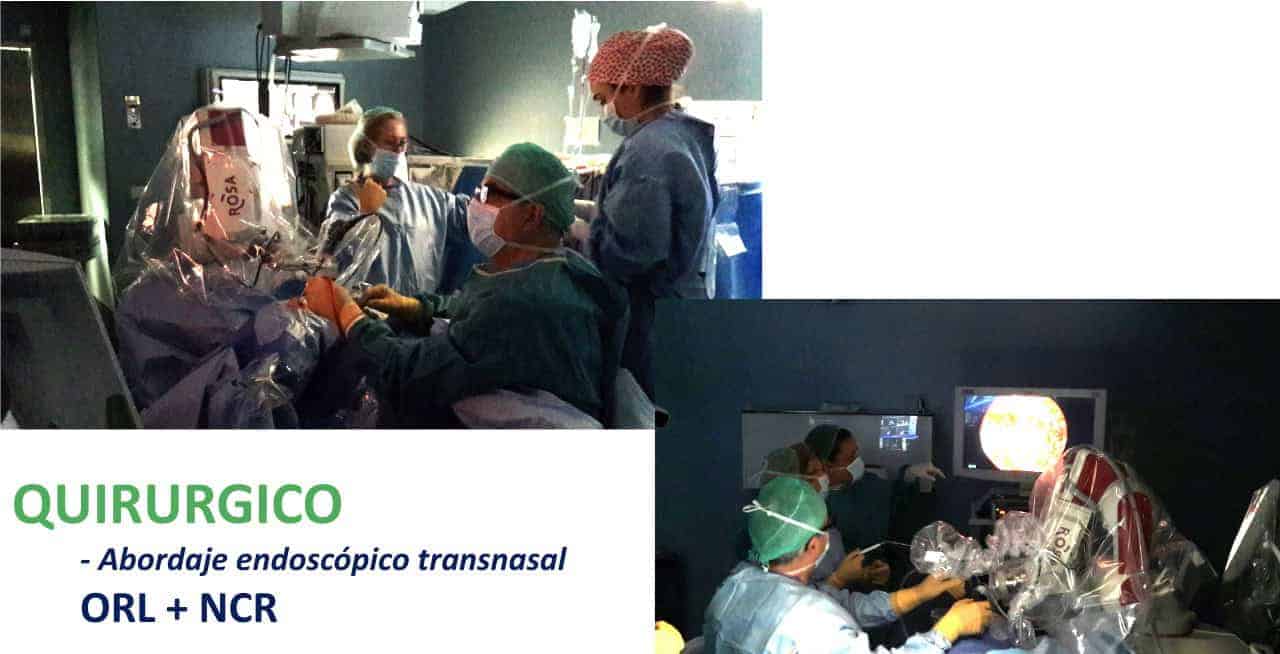 Figura 20-adenoma de hipofisis-tratamiento