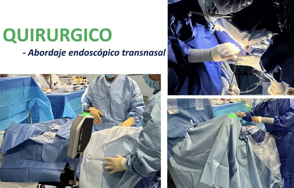 Figura 21-adenoma de hipofisis-tratamiento