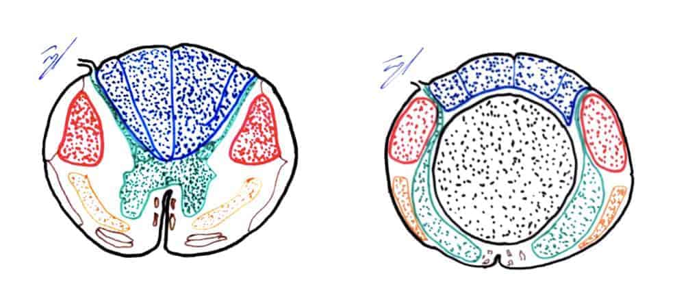natomia normal y tumoral