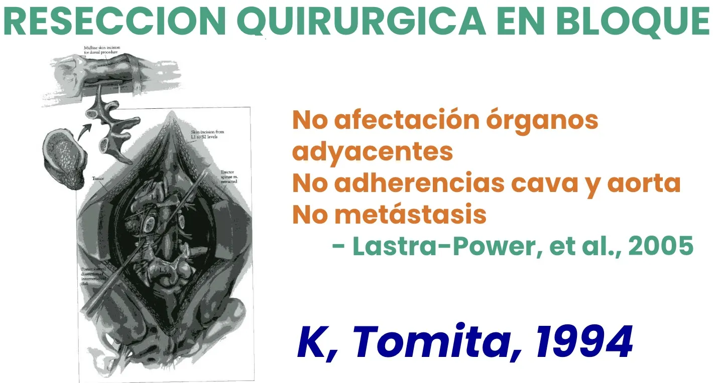 Figura 14.- Tumores malignos primarios - Sarcoma de Ewing resección en bloque