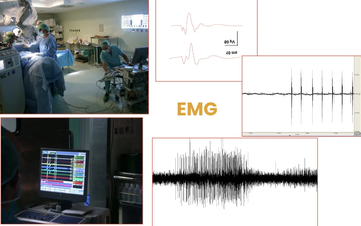 Figura 36.- Equipamiento neuroquirúrgico - Neurofisiología intraoperativa - electromiograma - EMG