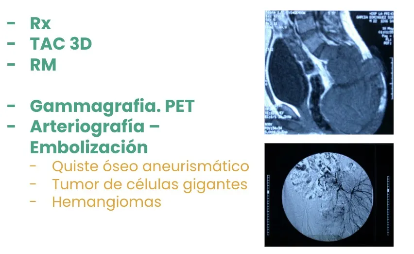 Figura 4.- Tumores primarios - Diagnóstico