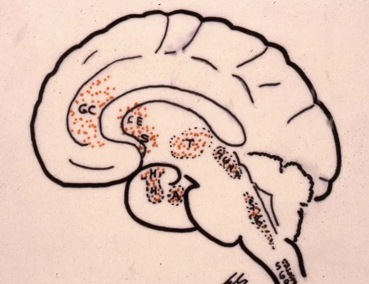 Clasificación de medicamentos para el tratamiento del dolor: analgésicos no esteroideos antiinflamatorios (aspirina, paracetamol, nolotil, ibuprofeno) y opiáceos (morfina, codeína, sintéticos como fentanilo y metadona). El diagrama cerebral muestra la distribución de receptores opioides en diferentes regiones del sistema nervioso central.