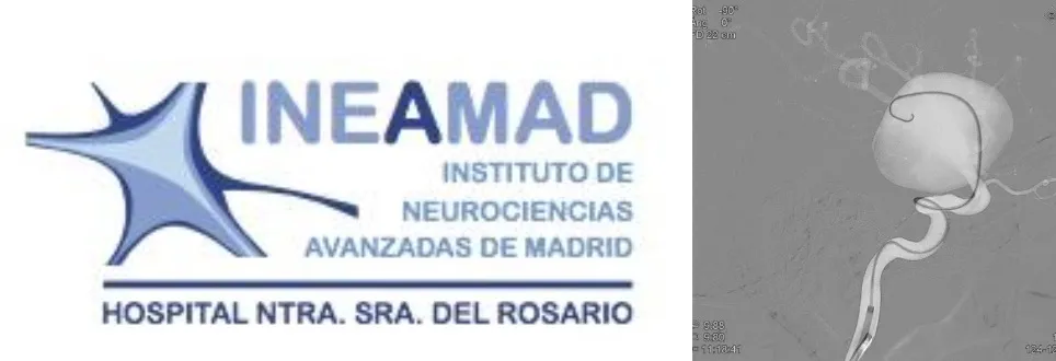 Equipo multidisciplinario del código ictus en el Hospital del Rosario - INEAMAD