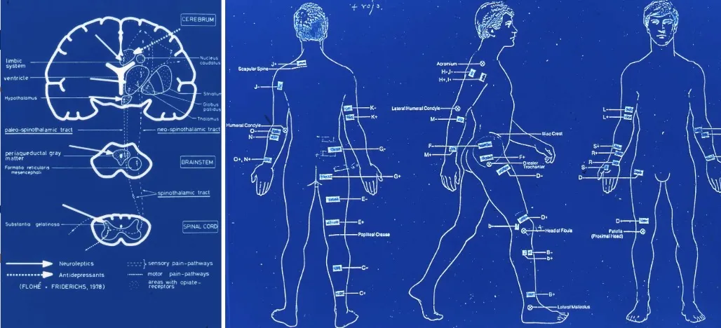 Antidepresivos tricíclicos, anticonvulsivantes (tegretol, gabapentina) y neuroestimulación transcutánea (TENS). Los diagramas muestran las vías neuroquímicas involucradas en el efecto analgésico de estos tratamientos y los puntos de aplicación del TENS en el cuerpo.