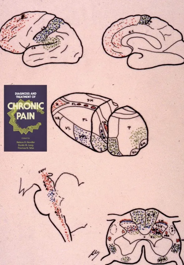 Estadio IV de Hendler: dolor hipercrónico (3 a 12 años). Sorprendentemente, a partir de los 3 años de dolor continuo, muchos pacientes experimentan una mejoría paradójica en su calidad de vida. Aprenden a convivir con el dolor aunque no lo aceptan, desarrollando estrategias de adaptación mientras siguen considerándolo injusto e indeseable.