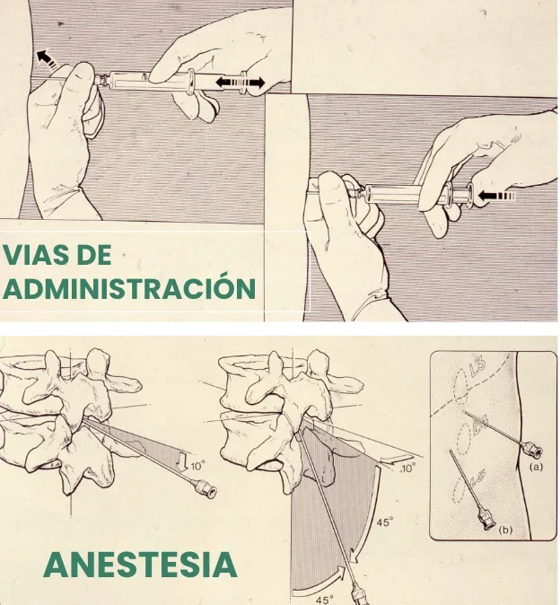 Vías de administración de medicamentos analgésicos y anestésicos: oral (P.O.), parches cutáneos, intramuscular (I.M.), intravenosa (I.V.), infiltración local, epidural, intratecal e intraventricular. Los diagramas anatómicos muestran las técnicas de administración espinal.
