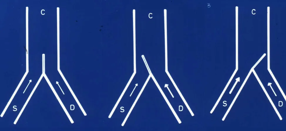 Teoría de la compuerta de Melzack y Wall: diagrama mostrando compuerta (C), estímulos sensoriales (S) y estímulos dolorosos (D) en tres situaciones diferentes.