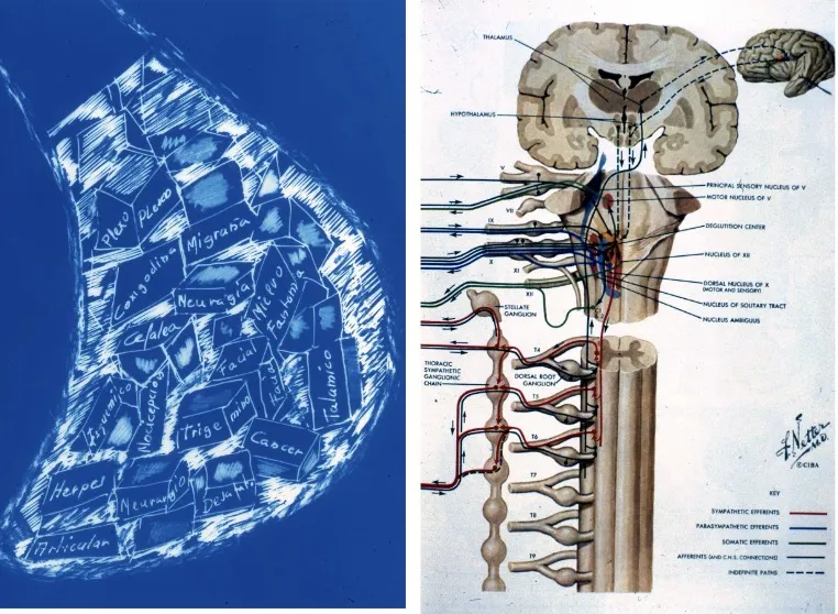 Clasificación del dolor: como síntoma, como enfermedad (concepto de Bonica) y como sistema complejo. Diagrama anatómico del sistema nervioso y las vías del dolor.