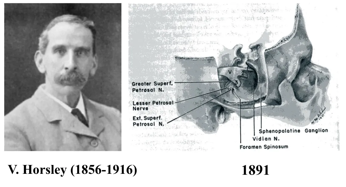Victor Horsley (1856-1916) y diagrama anatómico del ganglio de Gasser. Horsley realizó en 1891 la extirpación completa del ganglio de Gasser, una intervención extremadamente dramática para la época.